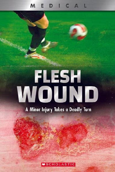 9780531132968 - Front cover